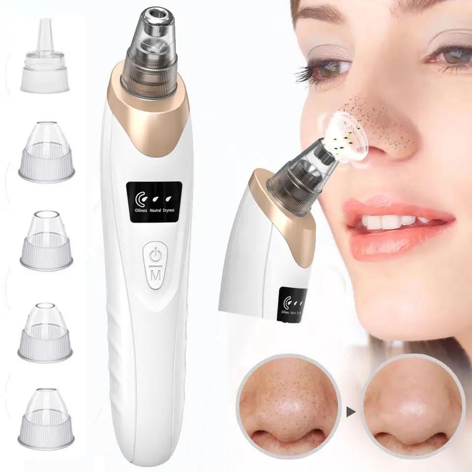 5-in-1 Blackhead Remover Vacuum