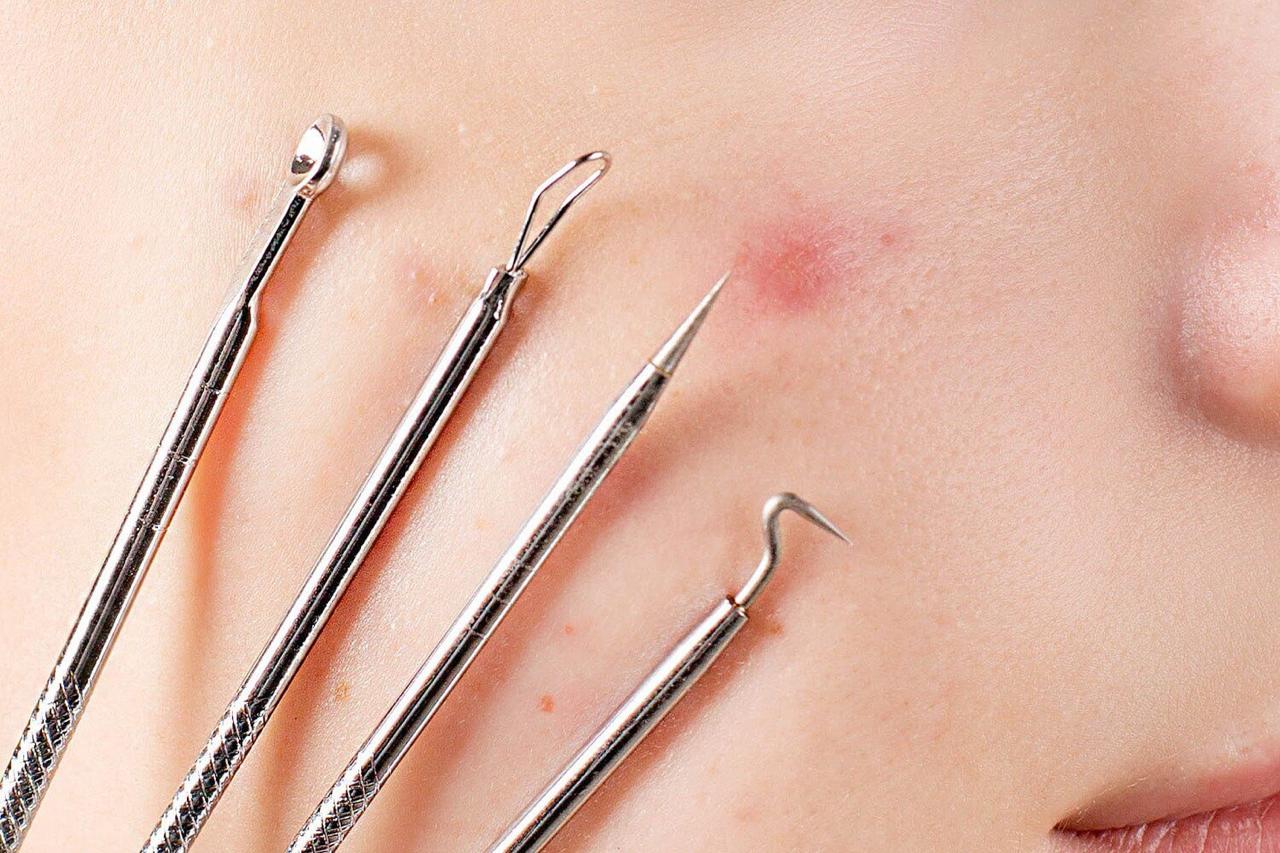 5-in-1 Blackhead Remover Vacuum